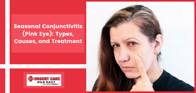 Seasonal Conjunctivitis (Pink Eye): Types, Causes, and Treatment